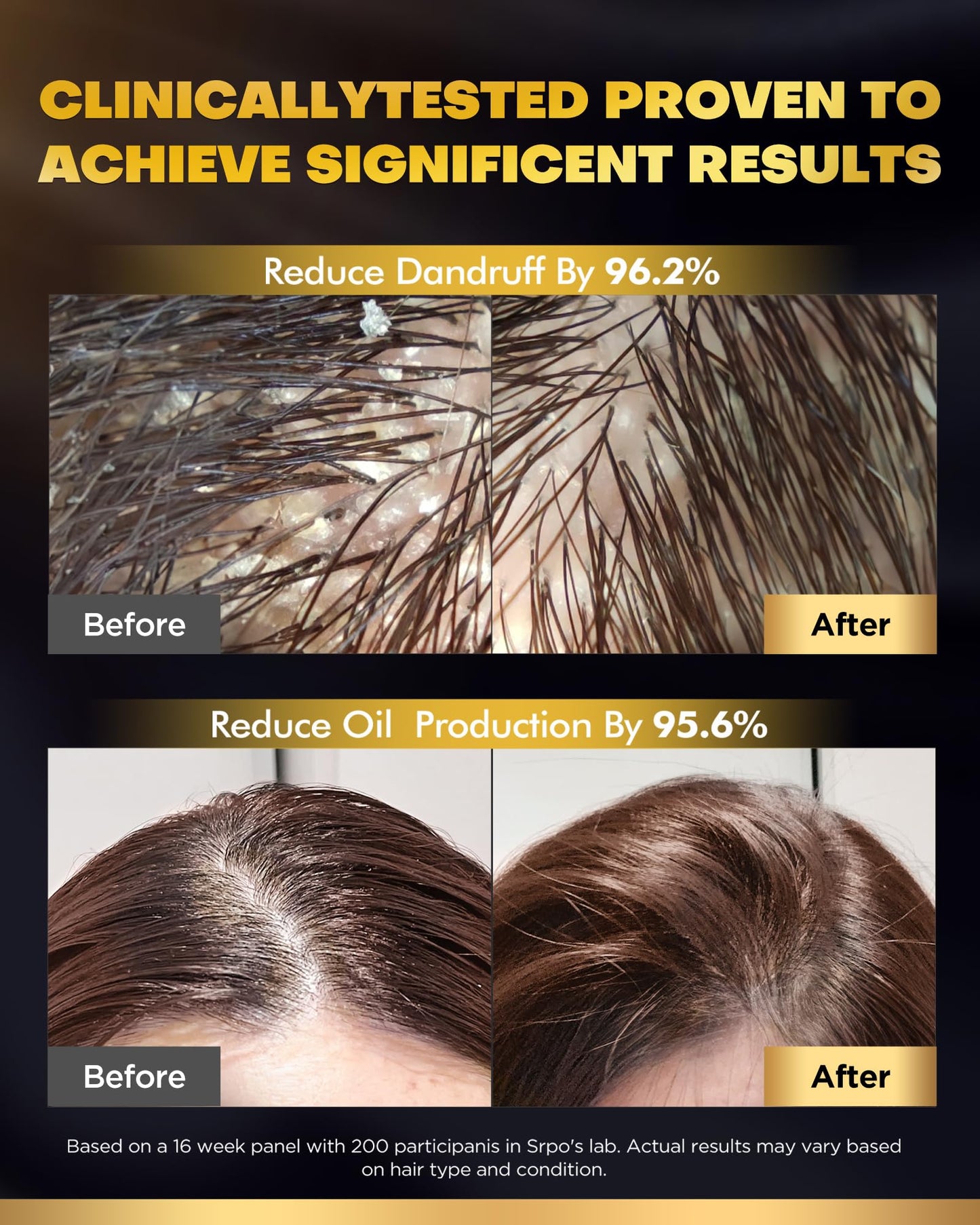 COOLKESI Tripeptide-Infused Biotin Hair Growth Shampoo and Conditioner Set, Onion Anti-Loss Volumizing Moisturizing Treatment for Soft Shine Hair, Dandruff Routine Shampoo for Men and Women, 2x16.9oz