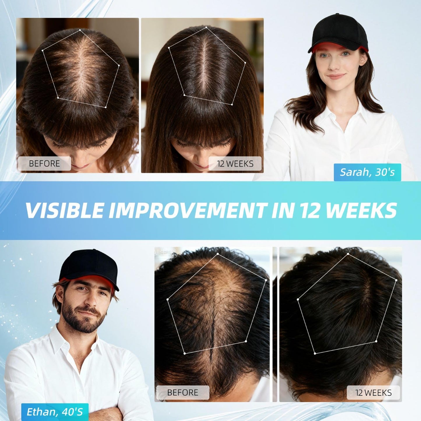 2026 Upgrade Wireless Laser Cap for Hair Regrowth,Rechargeable Red Light Therapy for Hair Growth